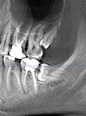 Снимок восьмерки