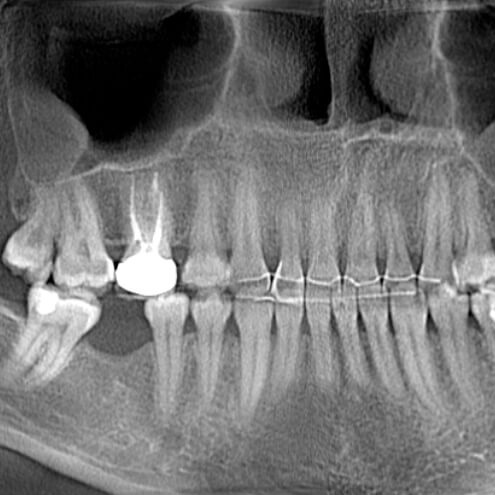 Снимок зубов