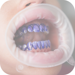 На зубы нанесн состав